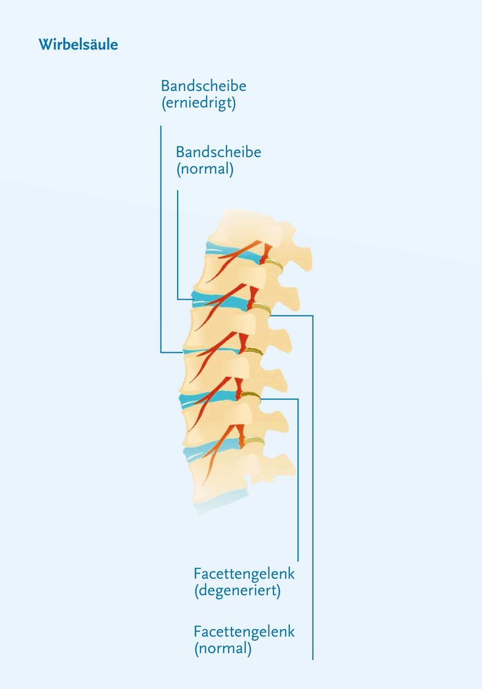 07 Fkb Mag26 H Indreischrittenzurschmerzquelle