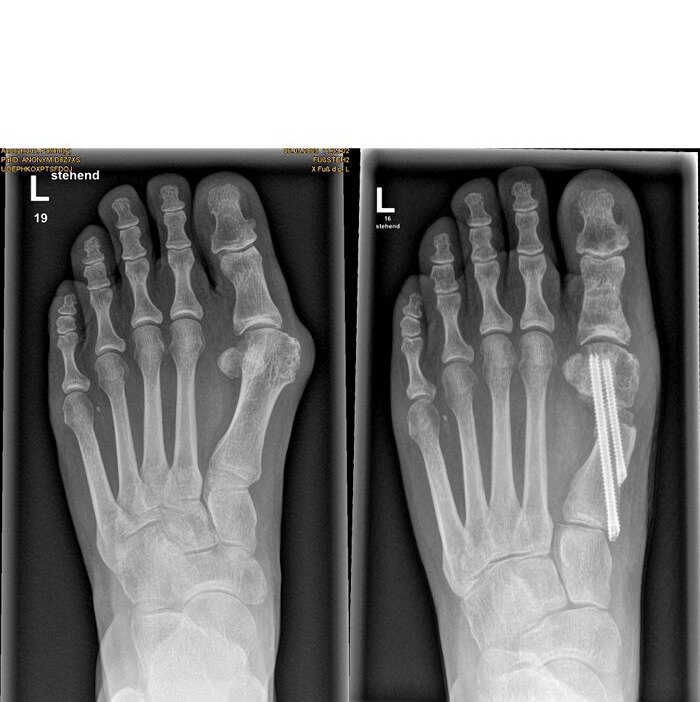 19 3 Fkb Mag39 Hoch 14